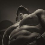gynecomastia surgery
