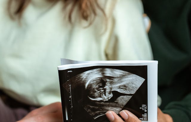 fertility issues